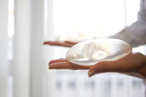 Breast Implants and Anaplastic Large Cell Lymphoma ALCL